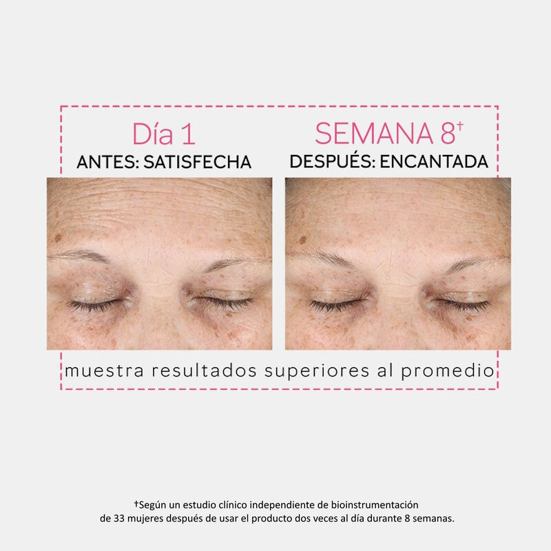 Before-and-after images showing average improvement between the eyebrows after 8 weeks of use