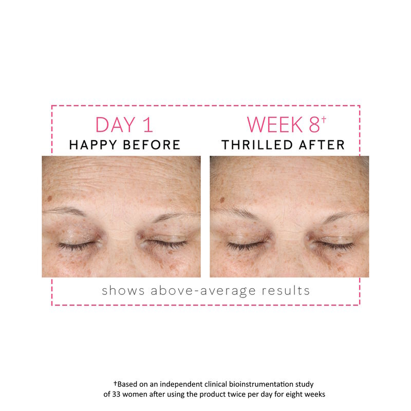 Before-and-after images showing average improvement between the eyebrows after 8 weeks of use